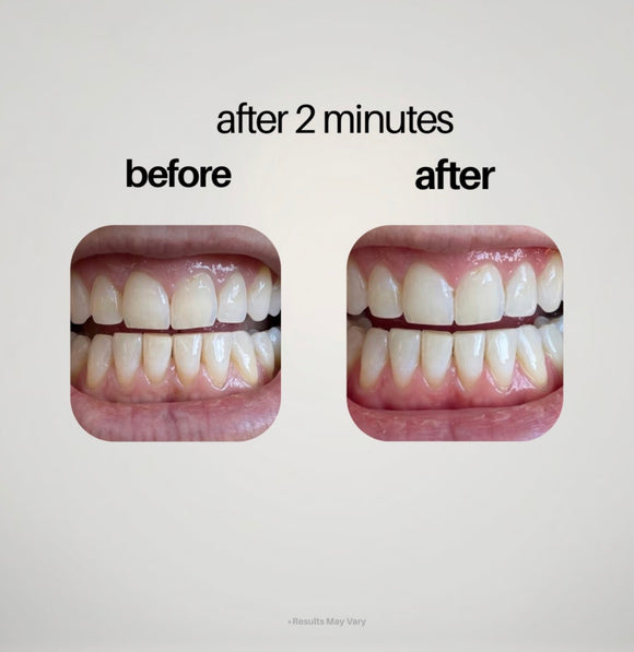 Feature product image