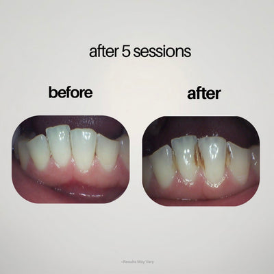 Planteet Gunk Removing Mouthwash