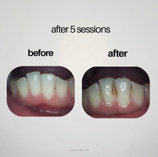 Planteet Gunk Removing Mouthwash