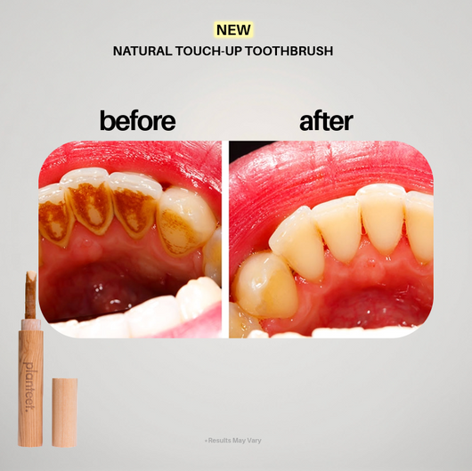 Planteet Touch-Up Toothbrush