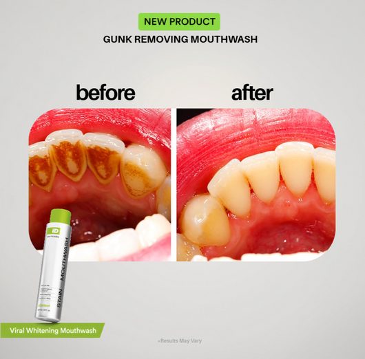 Planteet Gunk Removing Mouthwash