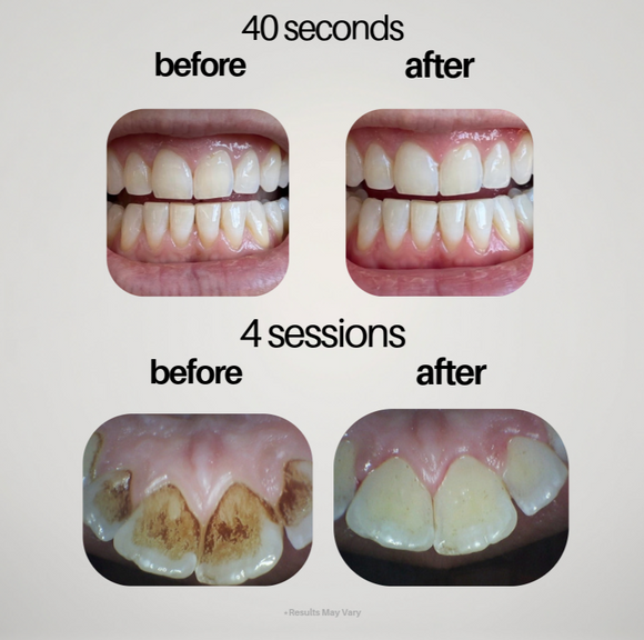 Feature product image